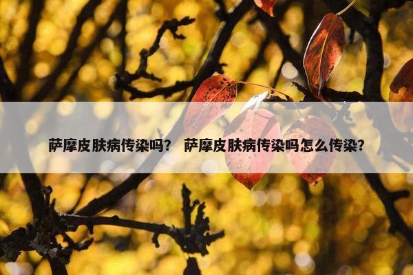 萨摩皮肤病传染吗？ 萨摩皮肤病传染吗怎么传染？