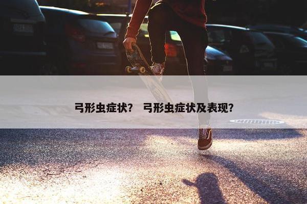 弓形虫症状？ 弓形虫症状及表现？